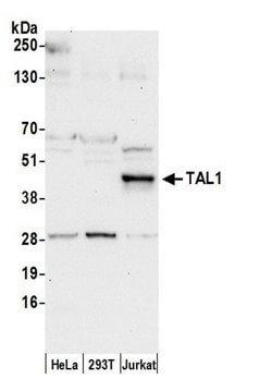 TAL1 Polyclonal Antibody, Bethyl Laboratories:Antibodies:Primary Antibodies