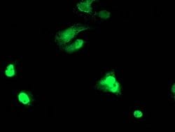 TAL1 Mouse anti-Human, Clone: OTI4A6, lyophilized, TrueMAB 100 &mu;g; Unconjugated:Antibodies,