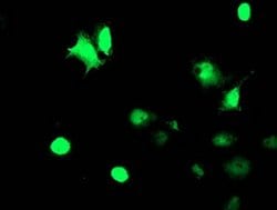 TAL1 Monoclonal Antibody (OTI5C4), TrueMAB , OriGene 100 &mu;L; Unconjugated:Antibodies,