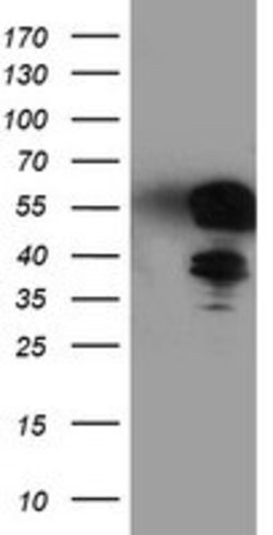 TAL1 Mouse anti-Human, Clone: OTI4A6, lyophilized, TrueMAB 100 &mu;g; Unconjugated:Antibodies,