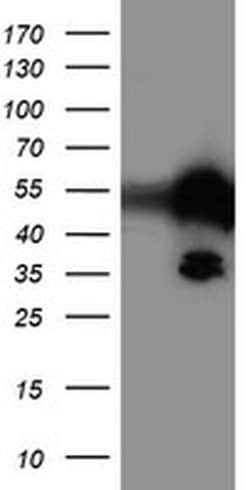 TAL1 Monoclonal Antibody (OTI4G10), TrueMAB , OriGene 30 &mu;L; Unconjugated:Antibodies,