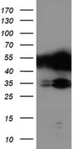 TAL1 Monoclonal Antibody (OTI5A5), TrueMAB , OriGene:Antibodies:Primary