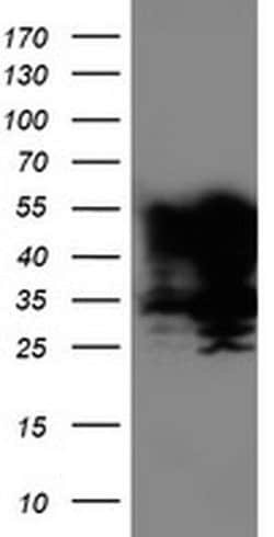 TAL1 Monoclonal Antibody (OTI3E2), TrueMAB , OriGene 30 &mu;L; Unconjugated:Antibodies,