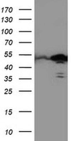 TAL1 Monoclonal Antibody (OTI5B12), TrueMAB , OriGene 100 &mu;L; Unconjugated:Antibodies,
