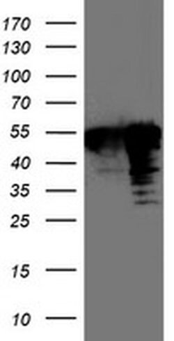 TAL1 Monoclonal Antibody (OTI6H6), TrueMAB , OriGene 100 &mu;L; Unconjugated:Antibodies,