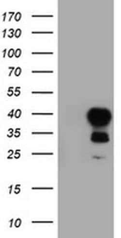TAL1 Mouse anti-Human, Clone: OTI5H1, liquid, TrueMAB 30 &mu;L | Buy Online | Origene Technologies | Fisher Scientific