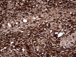 TALDO1 Mouse anti-Human, Clone: OTI2E4, lyophilized, TrueMAB 100 &mu;g;