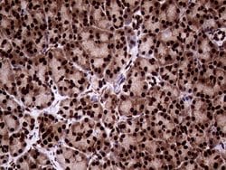 TALDO1 Mouse anti-Human, Clone: OTI2E4, lyophilized, TrueMAB 100 &mu;g;