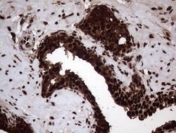 TALDO1 Mouse anti-Human, Clone: OTI2E4, lyophilized, TrueMAB 100 &mu;g;