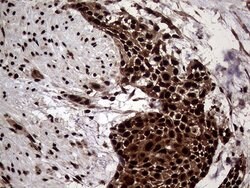 TALDO1 Mouse anti-Human, Clone: OTI2E4, lyophilized, TrueMAB 100 &mu;g;