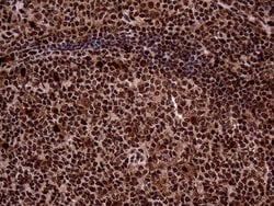 TALDO1 Mouse anti-Human, Clone: OTI2E4, lyophilized, TrueMAB 100 &mu;g;