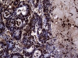 TALDO1 Mouse anti-Human, Clone: OTI2E4, lyophilized, TrueMAB 100 &mu;g;