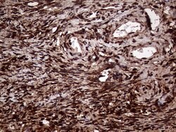 TALDO1 Monoclonal Antibody (OTI1E5), TrueMAB , OriGene 100 &mu;L; Unconjugated:Antibodies,
