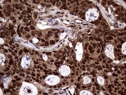 TALDO1 Monoclonal Antibody (OTI1E5), TrueMAB , OriGene 100 &mu;L; Unconjugated:Antibodies,