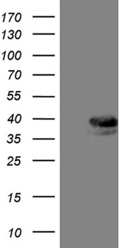 TALDO1 Mouse anti-Human, Clone: OTI2E4, lyophilized, TrueMAB 100 &mu;g;