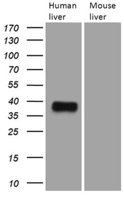 TALDO1 Mouse anti-Human, Clone: OTI2E4, lyophilized, TrueMAB 100 &mu;g;