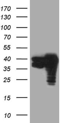 TALDO1 Mouse anti-Human, Clone: OTI4A7, lyophilized, TrueMAB 100 &mu;g;
