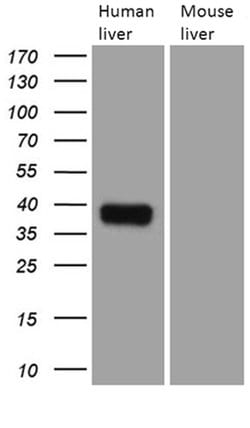 TALDO1 Mouse anti-Human, Clone: OTI4A7, lyophilized, TrueMAB 100 &mu;g;