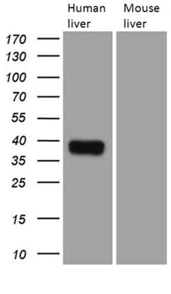 TALDO1 Monoclonal Antibody (OTI4A7), TrueMAB , OriGene 100 &mu;L; Unconjugated:Antibodies,