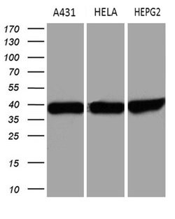 TALDO1 Mouse anti-Human, Clone: OTI4A7, lyophilized, TrueMAB 100 &mu;g;