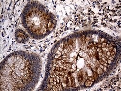 TANK Monoclonal Antibody (OTI1G2), TrueMAB , OriGene 100 &mu;L; Unconjugated:Antibodies,