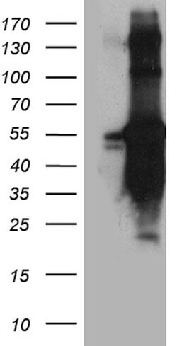 TANK Monoclonal Antibody (OTI1G2), TrueMAB , OriGene 100 &mu;L; Unconjugated:Antibodies,