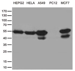 TANK Monoclonal Antibody (OTI1G2), TrueMAB , OriGene 100 &mu;L; Unconjugated:Antibodies,