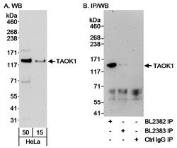 TAOK1 Rabbit anti-Human, Polyclonal, Bethyl Laboratories 100 &mu;L; Unconjugated:Antibodies,
