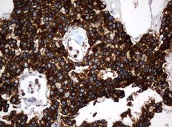 TAPBPL Monoclonal Antibody (OTI1C9), TrueMAB , OriGene 100 &mu;L; Unconjugated:Antibodies,