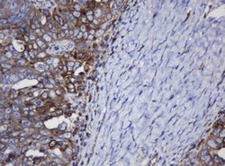 TAPBPL Mouse anti-Human, Clone: OTI5D7, lyophilized, TrueMAB 100 &mu;g;