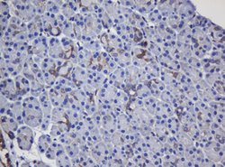 TAPBPL Mouse anti-Human, Clone: OTI5D7, lyophilized, TrueMAB 100 &mu;g;