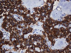TAPBPL Mouse anti-Human, Clone: OTI5D7, lyophilized, TrueMAB 100 &mu;g;