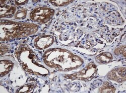 TAPBPL Mouse anti-Human, Clone: OTI5D7, lyophilized, TrueMAB 100 &mu;g;