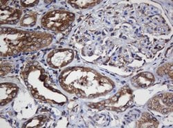 TAPBPL Monoclonal Antibody (OTI5D7), TrueMAB , OriGene 100 &mu;L; Unconjugated:Antibodies,