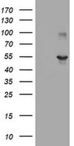 TAPBPL Monoclonal Antibody (OTI2E11), TrueMAB , OriGene 30 &mu;L | Buy Online | OriGene | Fisher Scientific