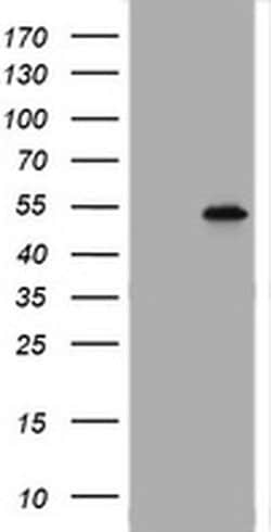 TAPBPL Monoclonal Antibody (OTI5D7), TrueMAB , OriGene 100 &mu;L; Unconjugated:Antibodies,