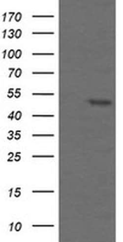 TAPBPL Monoclonal Antibody (OTI2A4), TrueMAB , OriGene 100 &mu;L; Unconjugated:Antibodies,