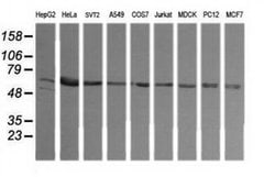 TAPBPL Monoclonal Antibody (OTI2A4), TrueMAB , OriGene 100 &mu;L; Unconjugated:Antibodies,
