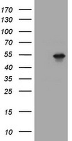 TAPBPL Monoclonal Antibody (OTI5E5), TrueMAB , OriGene 100 &mu;L; Unconjugated:Antibodies,