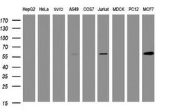 TAPBPL Mouse anti-Human, Clone: OTI2D6, lyophilized, TrueMAB 100 &mu;g;