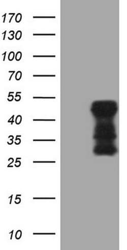 TARBP2 Monoclonal Antibody (OTI7C1), TrueMAB , OriGene:Antibodies:Primary