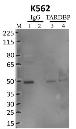 Invitrogen TDP-43 Recombinant Superclonal Antibody (1HCLC) 100 &mu;g; Unconjugated:Antibodies,