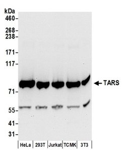 TARS Polyclonal Antibody, Bethyl Laboratories 20 &mu;L; Unconjugated:Antibodies,