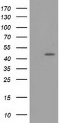 TASP1 Mouse anti-Human, Clone: OTI1H6, lyophilized, TrueMAB 100 &mu;g;