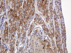 TBC1D13 Monoclonal Antibody (OTI2C5), TrueMAB , OriGene 100 &mu;L; Unconjugated:Antibodies,