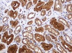 TBC1D13 Monoclonal Antibody (OTI2C5), TrueMAB , OriGene 100 &mu;L; Unconjugated:Antibodies,