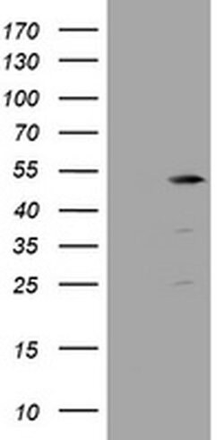 TBC1D13 Monoclonal Antibody (OTI2C5), TrueMAB , OriGene 100 &mu;L; Unconjugated:Antibodies,