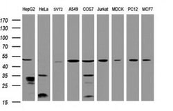 TBC1D13 Monoclonal Antibody (OTI2C5), TrueMAB , OriGene:Antibodies:Primary