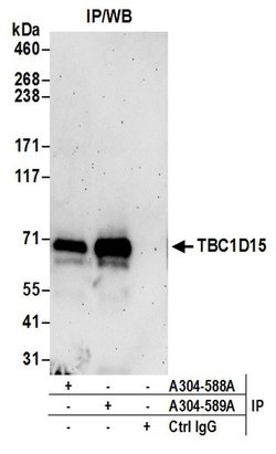 TBC1D15 Rabbit anti-Human, Mouse, Polyclonal, Bethyl Laboratories 100 &mu;L | Buy Online | Bethyl Laboratories, Inc | Fisher Scientific