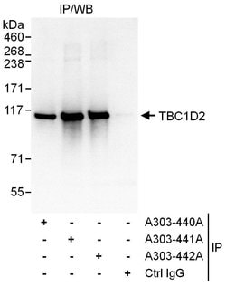 TBC1D2 Rabbit anti-Human, Polyclonal, Bethyl Laboratories 10 &mu;L; Unconjugated:Antibodies,